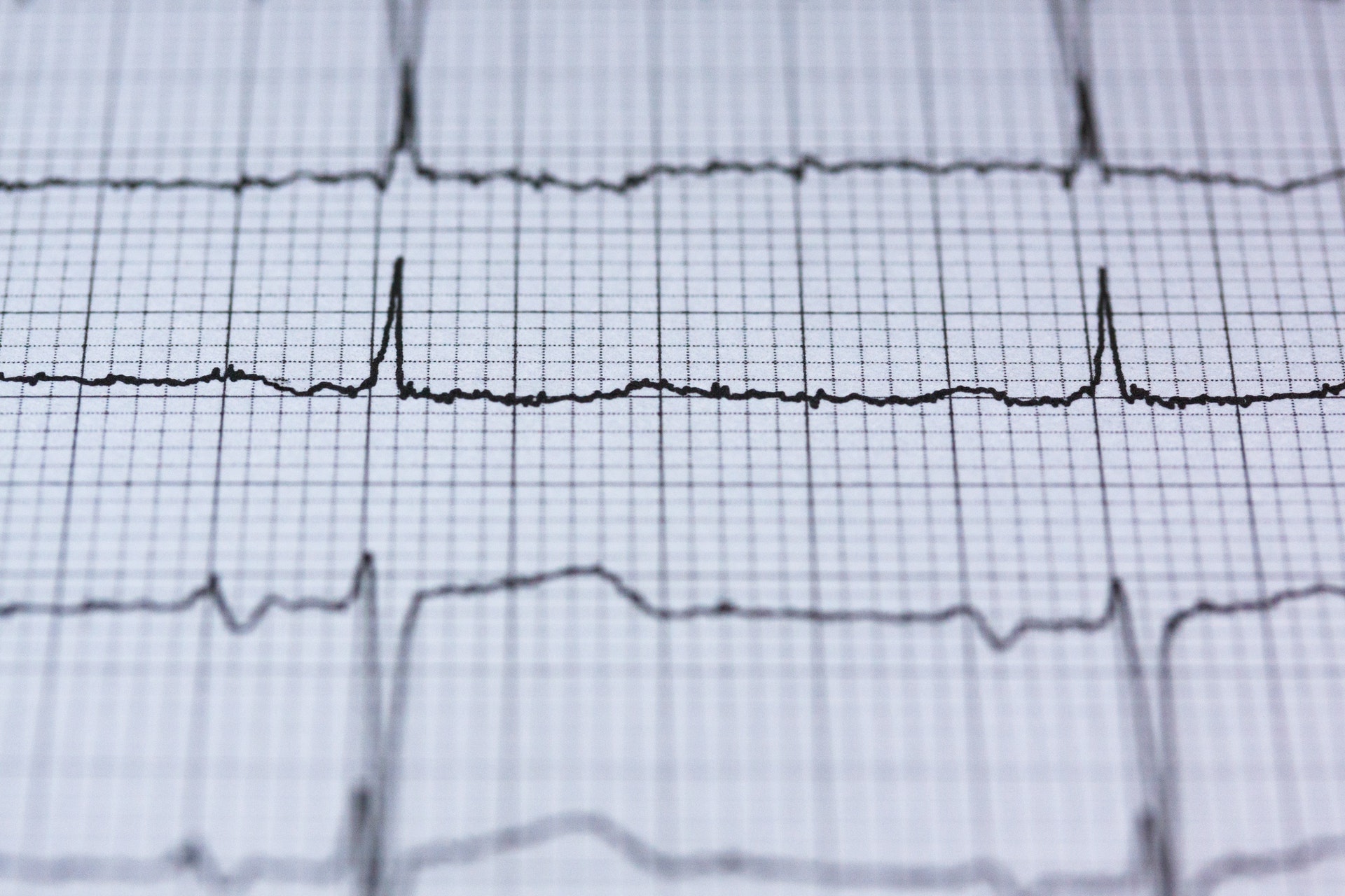 Blur Chart Check Up Curve 415779